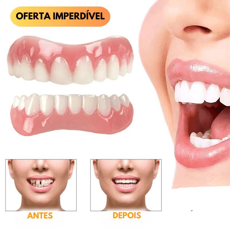 Dentadura Universal NewSmile - FRETE GRÁTIS - Lojão do Consumidor