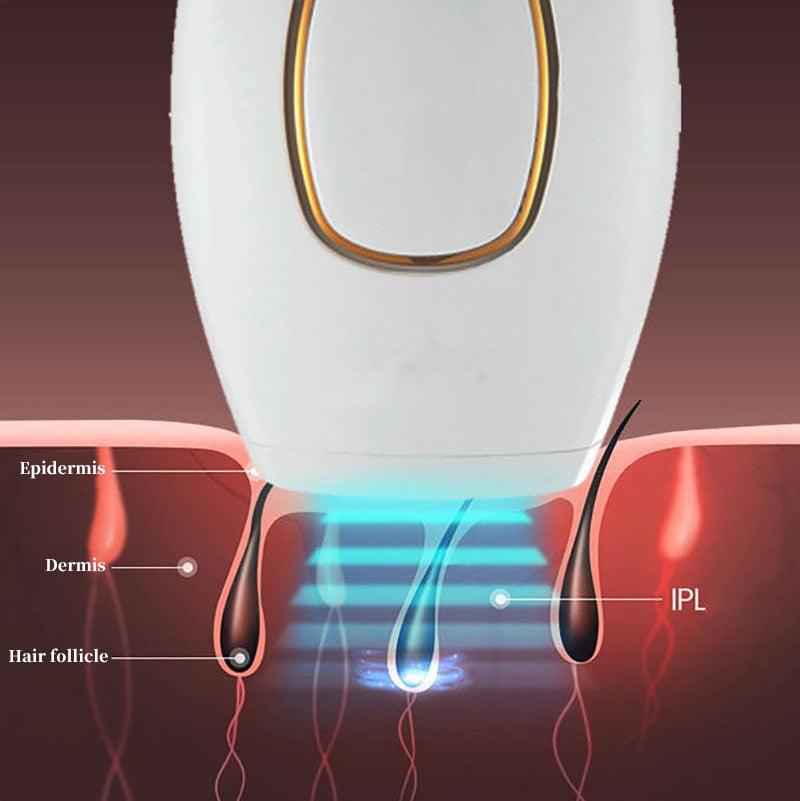 Depilador a Laser Definitivo Importado/LaserDepil - Lojão do Consumidor